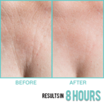 Sio Beauty Decollete Wrinkle Smoother